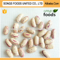 Chinese Dry Big Size Light Speckled Kidney Beans